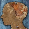 Beyin ve Alzheimer – Beyni Yaşlanmaktan Koruyun