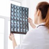 Çocuk ve Zeka – Çocuklardaki Zeka Seviyesi Yaşam Süresini Etkiliyor